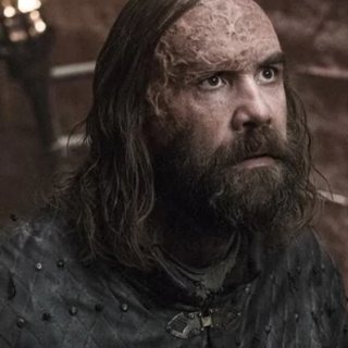 Sandor Clegane, played by Rory McCann